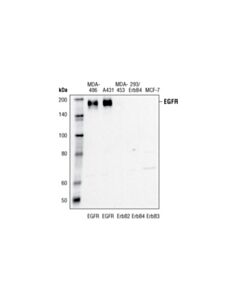 Cell Signaling EGF Receptor (15F8) Rabbit mAb 20 uL