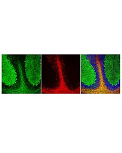 Cell Signaling Anti-Rat Igg (H+L), (Alexa Fluor<LT/>Sup&Gt;®<LT/>/Sup&Gt; 555 Conjugate)
