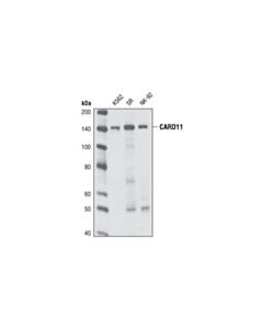 Cell Signaling Card11 (1d12) Rabbit mAb