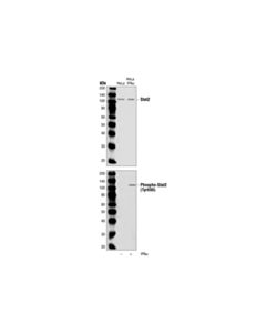 Cell Signaling Phospho-Stat2 (Tyr690) Antibody