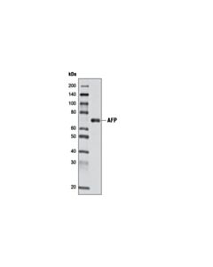 Cell Signaling AFP (D12C1) Rabbit mAb 20 uL