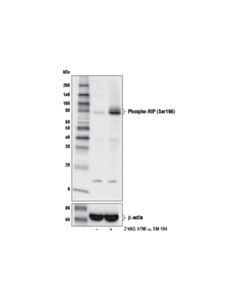 Cell Signaling Phospho-Rip (Ser166) (D8i3a) Rabbit mAb