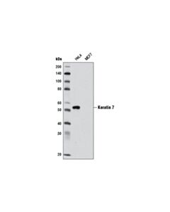 Cell Signaling Keratin 7 (D1e4) Xp Rabbit mAb