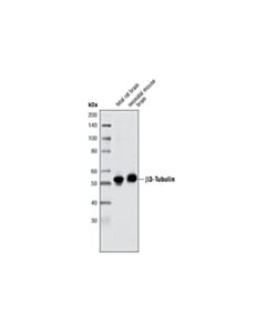 Cell Signaling beta3-Tubulin (TU-20) Mouse mAb
