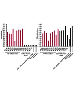 Cell Signaling Pathscan ® Tau (Gt-38) Sandwich ELISA Kit