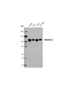 Cell Signaling Smarcal1 (D3p5i) Rabbit mAb
