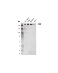Cell Signaling Chd5 (D2f9q) Rabbit mAb