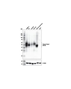 Cell Signaling Tissue Factor/CD142 (E2L3B) Rabbit mAb 20 uL