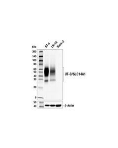 Cell Signaling Ut-B/Slc14a1 (E3s8j) Rabbit mAb