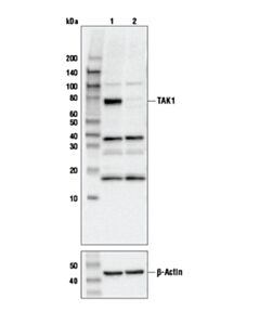 Cell Signaling Tak1 Antibody