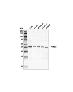 Cell Signaling Prame Antibody