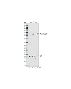 Cell Signaling Phospho-P38 Mapk (Thr180/Tyr182) (D3f9) Xp Rabbit mAb