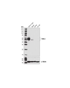 Cell Signaling Tim-3 (D5d5r) Xp<LT/>Sup&Gt;®<LT/>/Sup&Gt; Rabbit mAb