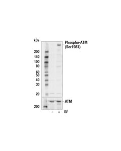 Cell Signaling Phospho-Atm (Ser1981) (10h11.E12) Mouse mAb