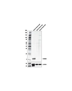 Cell Signaling S100A7 (E7X2C) Rabbit mAb 20 uL