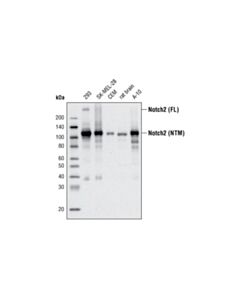 Cell Signaling Notch2 (D67c8) Xp Rabbit mAb