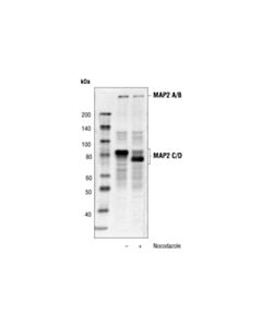 Cell Signaling Map2 Antibody