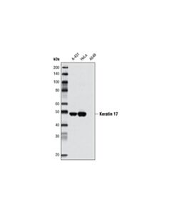 Cell Signaling Keratin 17 (D73c7) Rabbit mAb