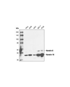 Cell Signaling Keratin 8/18 (C51) Mouse mAb