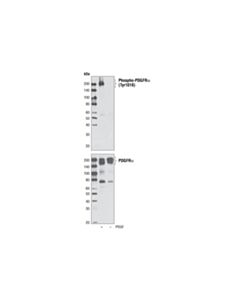 Cell Signaling Phospho-Pdgf Receptor Alpha (Tyr1018) Antibody
