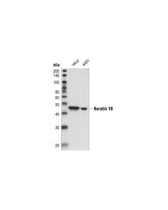 Cell Signaling Keratin 18 (Dc10) Mouse mAb