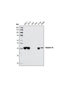 Cell Signaling Keratin 19 (Ba17) Mouse mAb