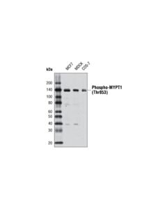 Cell Signaling Phospho-Mypt1 (Thr853) Antibody