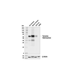 Cell Signaling Tyrosine Hydroxylase (LNC1) Mouse Monoclonal Antibody