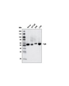 Cell Signaling Lyn (5G2) Mouse mAb 20 uL