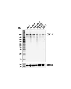Cell Signaling CDK12 (E8G6X) Rabbit mAb