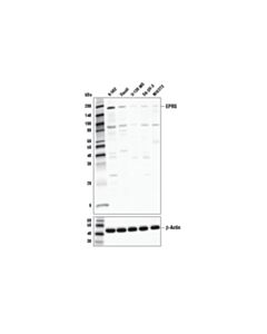 Cell Signaling Eprs Antibody