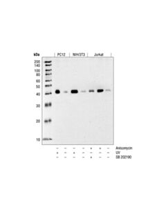 Cell Signaling Phospho-P38 Mapk (Thr180/Tyr182) (12f8) Rabbit mAb