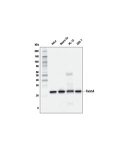 Cell Signaling Rab5a (E6n8s) Mouse mAb
