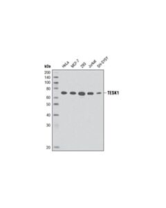 Cell Signaling Tesk1 (D49d4) Rabbit mAb