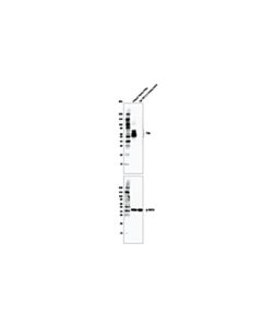 Cell Signaling Tau (D1m9x) Xp Rabbit mAb