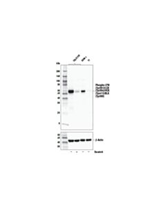 Cell Signaling Phospho-LYN (Tyr397)/LCK (Tyr394)/HCK (Tyr411)/BLK (Tyr389) (E5L3D) Rabbit mAb (BSA and Azide Free)