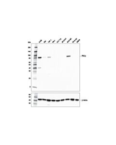 Cell Signaling PKCbeta (D3E7O) Rabbit mAb 20 uL