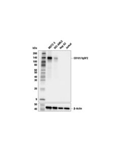 Cell Signaling CD101/IgSF2 (F6H5E) Rabbit Monoclonal Antibody