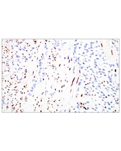 Cell Signaling Basic FGF (E5Y6M) Rabbit mAb 20 uL