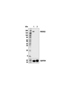 Cell Signaling ROCK2 (E5T5P) Rabbit mAb 20 uL