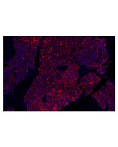 Cell Signaling Keratin 5 (E2T4B) XP Rabbit mAb (Alexa Fluor 647 Conjugate) 100 uL