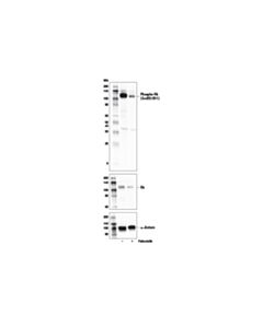 Cell Signaling Palbociclib