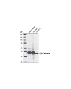Cell Signaling beta2-Chimerin (2E3) Rat mAb 20 uL