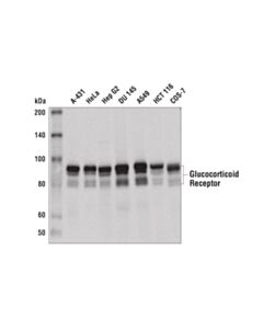 Cell Signaling Glucocorticoid Receptor (D4x9s) Mouse mAb