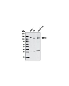 Cell Signaling PhosphoPlus ® DDR1 (Tyr792) Antibody Duet