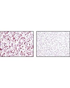 Cell Signaling Tra-1-81 (Tra-1-81) Mouse mAb