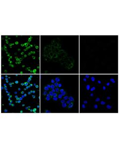 Cell Signaling Fgl1 (E8v9q) Rabbit mAb