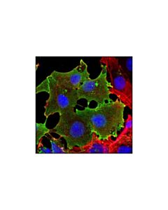 Cell Signaling Ssea4 (Mc813) Mouse mAb