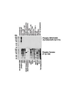 Cell Signaling Phospho-Her4/Erbb4 (Tyr1284) (21a9) Rabbit mAb