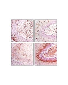 Cell Signaling Nestin (Rat-401) Mouse mAb